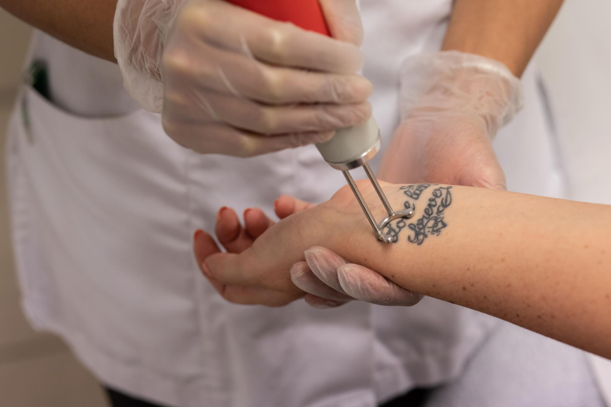 How Does Laser Tattoo Removal Work? | Rockwall Laser Tattoo Removal |  Juvanew Medspa