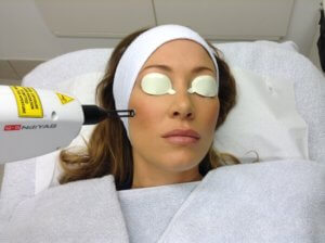 Hollywood Facial