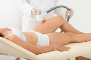 Stretch Mark Removal
