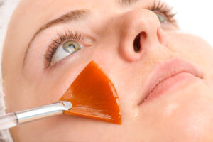 Problem Skin Peel
