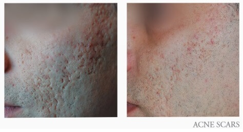Before and After