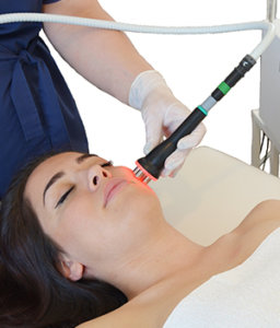 Radiofrequency Facial