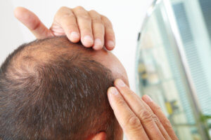 Men’s Hair Loss Treatment