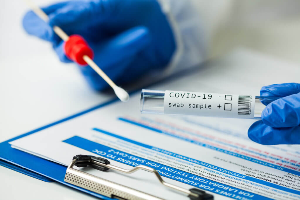 COVID-19 Antigen Test