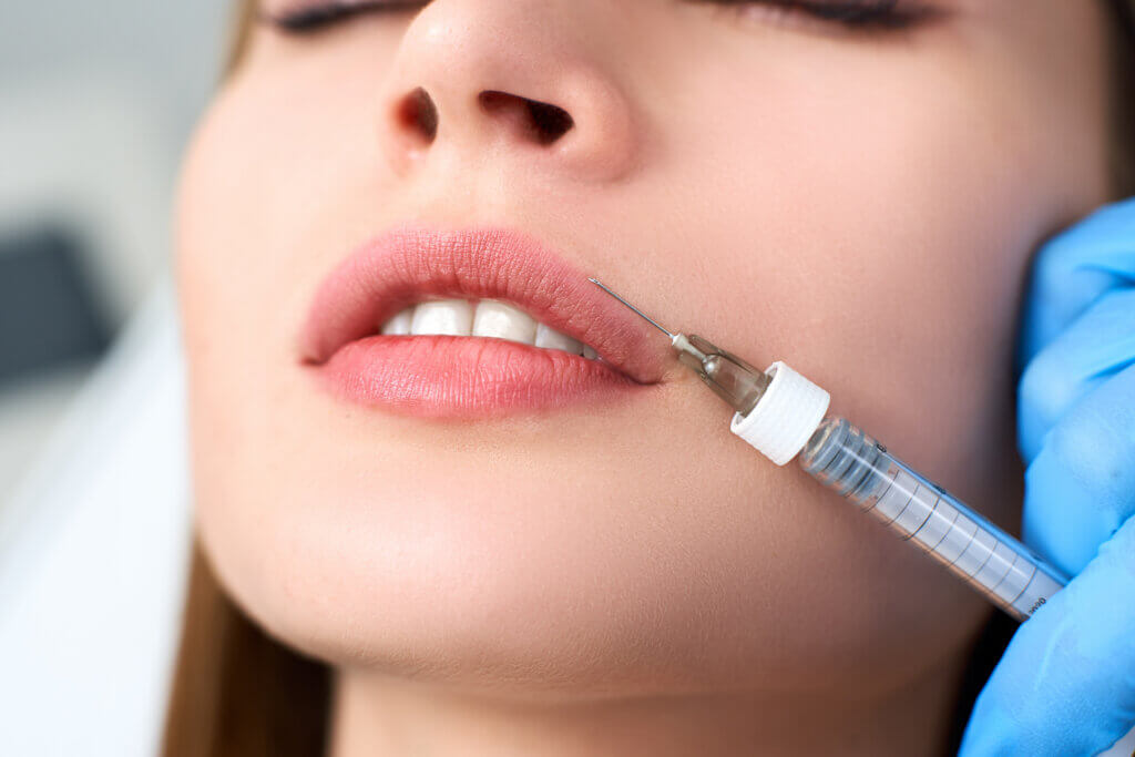Lip fillers will help you find your smile