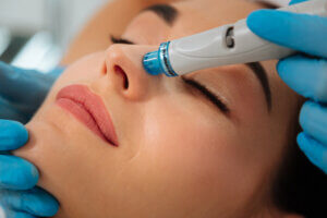 Close up of woman receiving hydrafacial on nose area