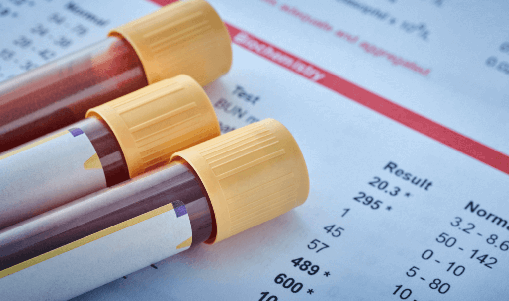 Anti-Mullerian Hormone (AMH) - Private Blood Tests