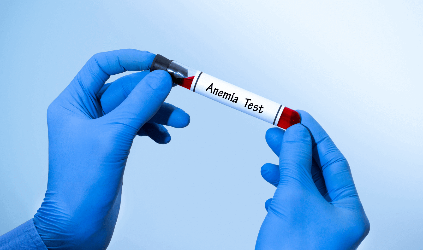 Anaemia Blood Tests