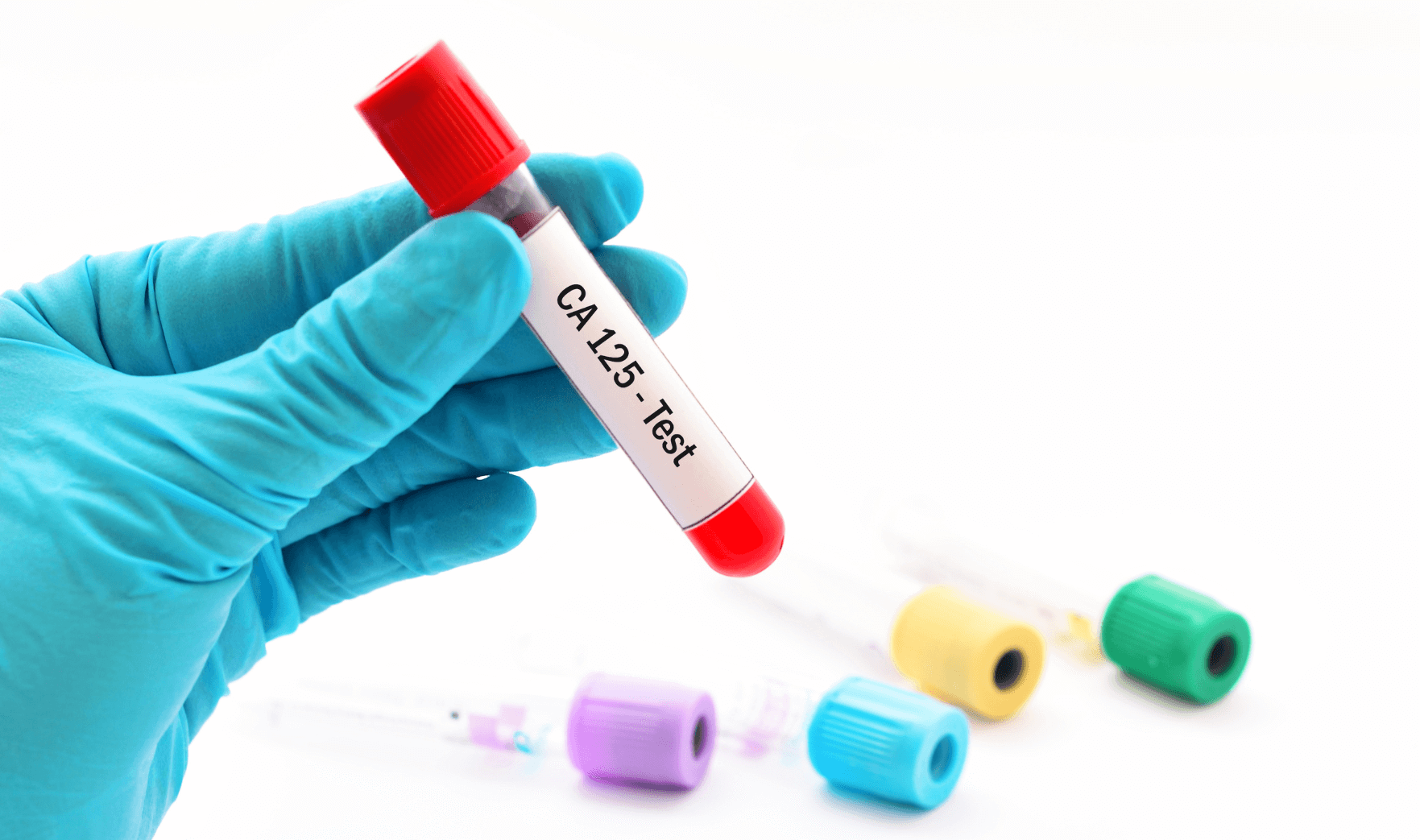 ca-125-blood-test-private-blood-screening