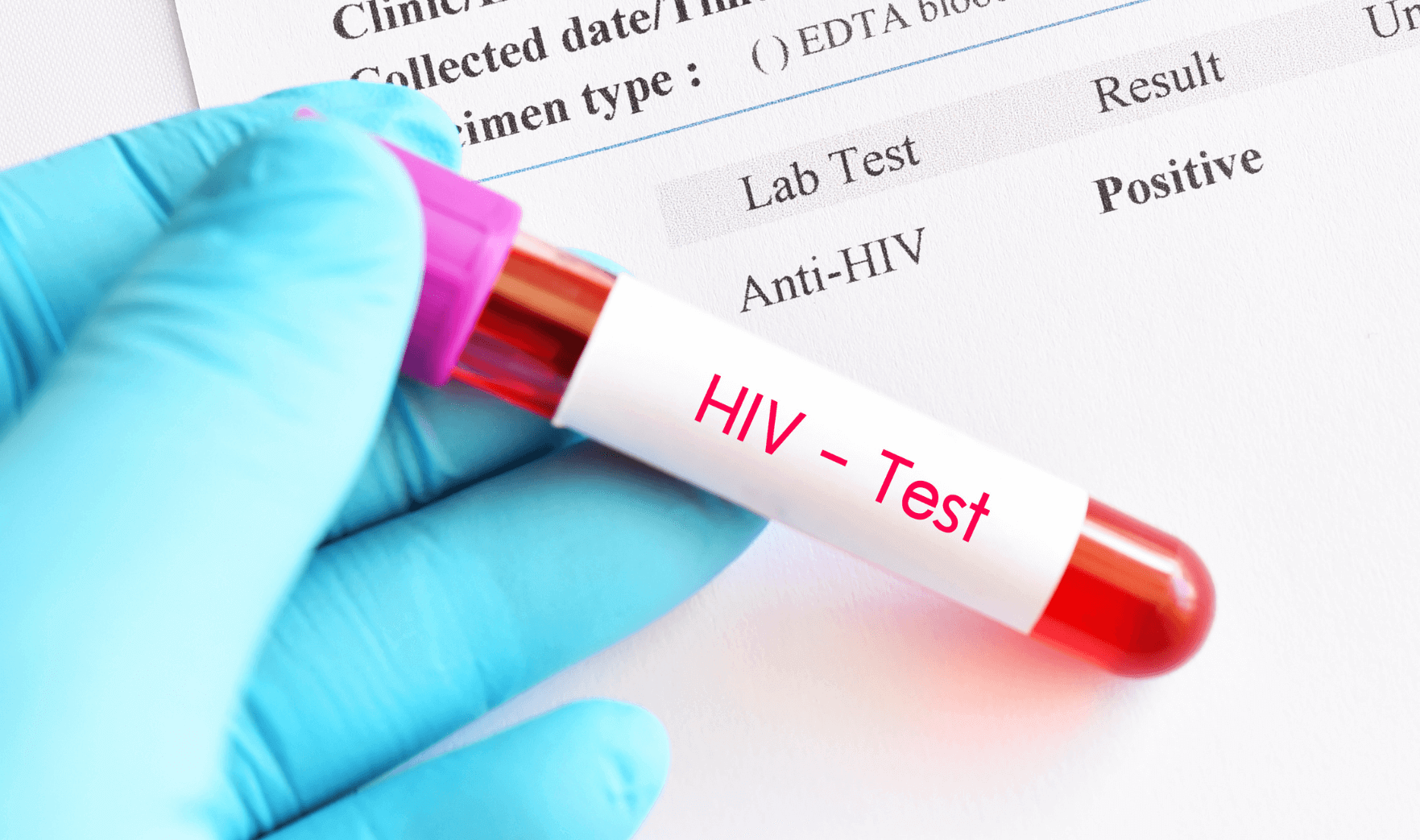 Would A Normal Blood Test Show Hiv