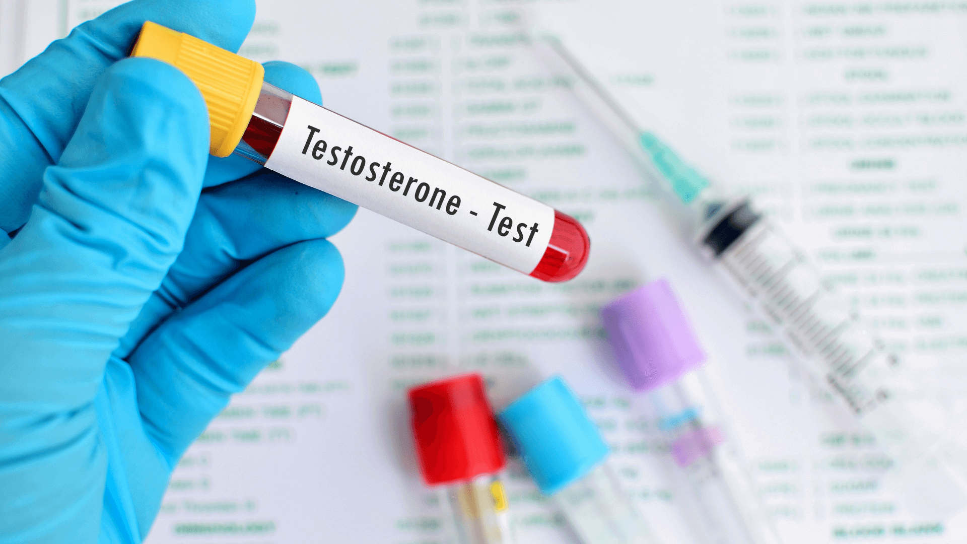 testosterone-levels-private-blood-tests