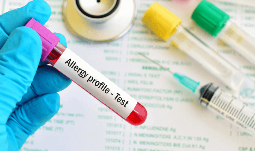Allergy Blood Tests