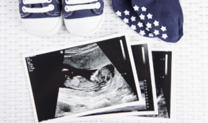 gender ultrasound scan report