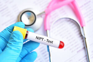 NIPT + Scan