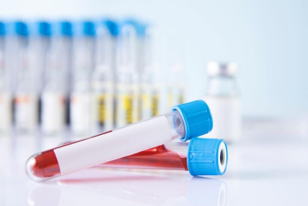 The 7 Most Essential Blood Tests