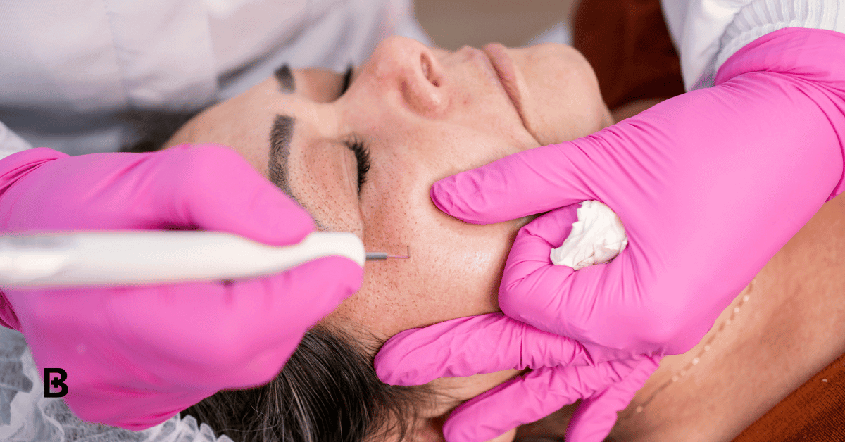 Doctor performing on non-surgical eyelift