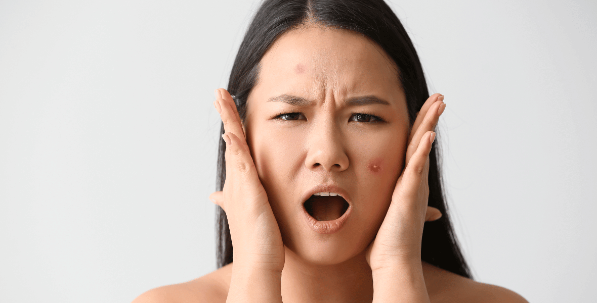 Understanding The Impact Of Stress On Skin Health