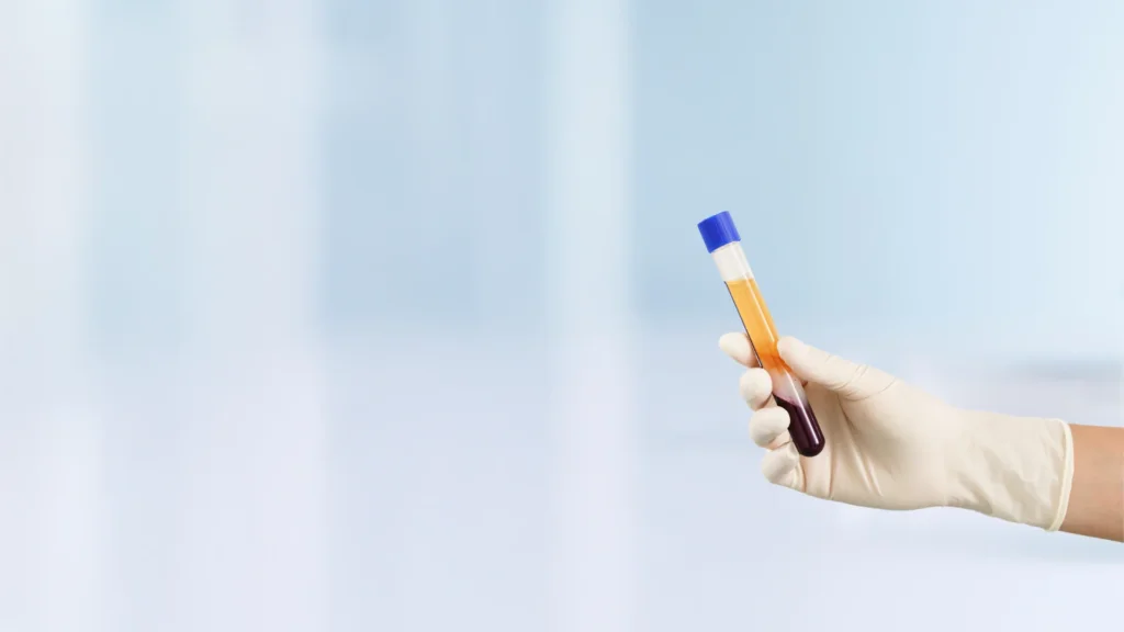 HIV Test