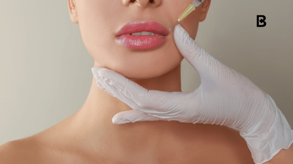 Thinking About Lip Fillers?