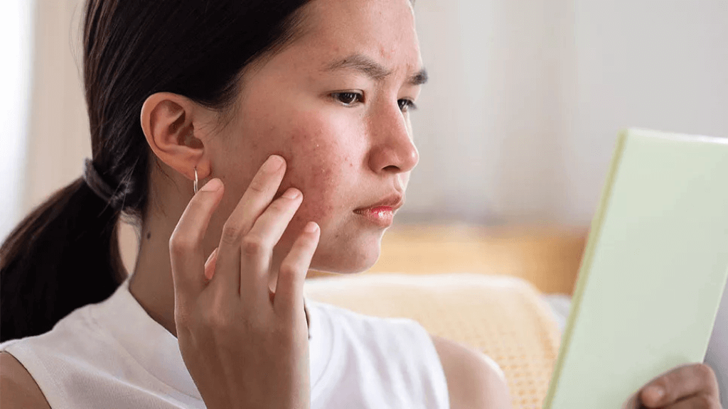 A woman examines her face for acne while holding a tablet, reflecting concern and self-care.